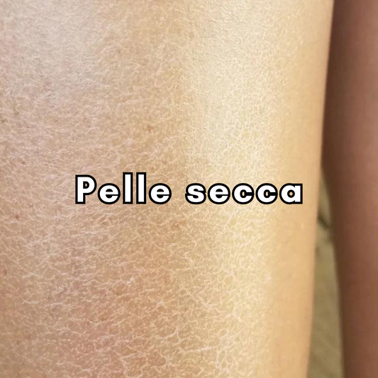 Combatti la pelle secca: I segreti per una pelle luminosa ed idratata